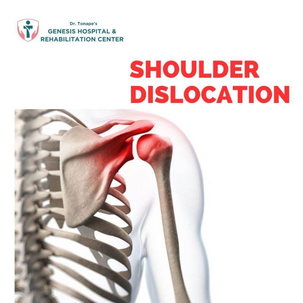 Learn about Shoulder Dislocation: Causes, Symptoms, and Treatment. Consult a skilled Orthopedic surgeon in Pimpri Chinchwad