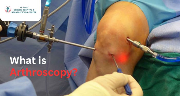 Learn everything about arthroscopy — a modern, minimally invasive solution for joint pain and injuries. Discover benefits, risks, and recovery tips from expert orthopedic care.
