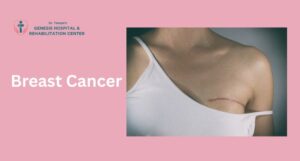 Learn all about breast cancer—symptoms, risk factors, diagnosis, and treatments. Get expert insights from a trusted breast cancer specialist.