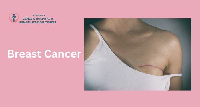 Learn all about breast cancer—symptoms, risk factors, diagnosis, and treatments. Get expert insights from a trusted breast cancer specialist.