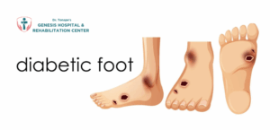 Diabetic foot Care in Pimpri-Chinchwad